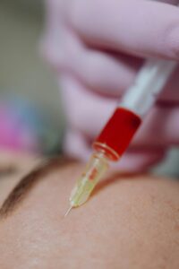 Close-up of a micro-needling device in use